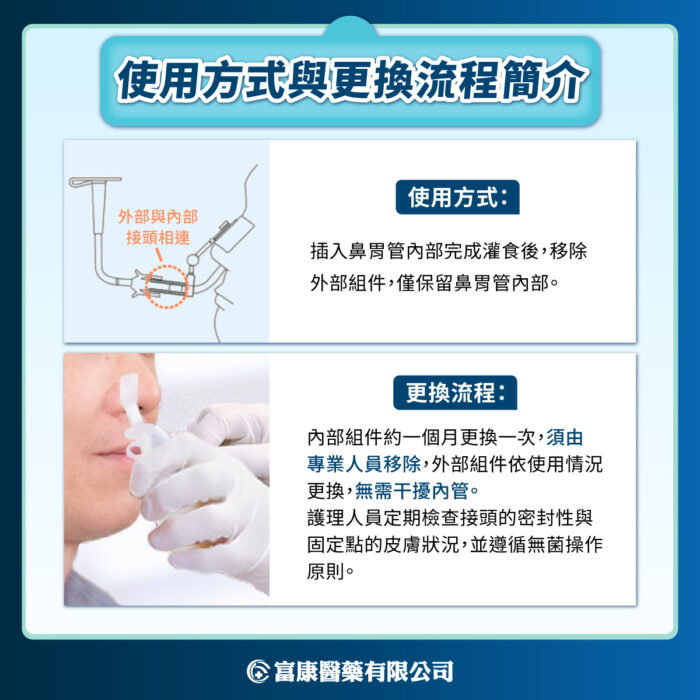 長期鼻胃管餵食照護選擇|為什麼越來越多醫師推薦兩截式鼻胃管?|富康醫藥