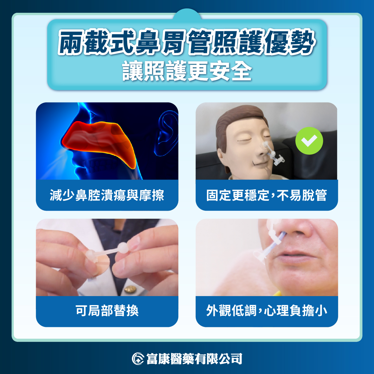 照顧鼻胃管病人,怎麼做最安全?兩截式鼻胃管的實用優勢與教學 兩截式鼻胃管的照護優勢