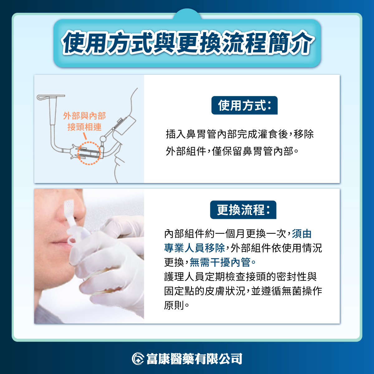 兩段式鼻胃管使用方式與更換流程簡介