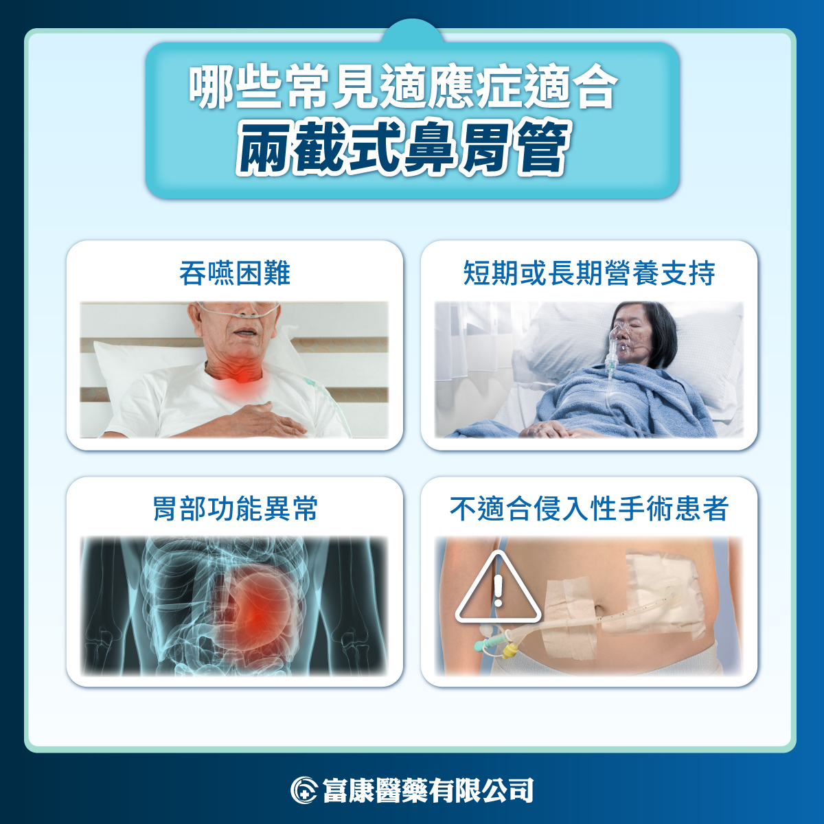 長期鼻胃管餵食的照護選擇:為什麼越來越多醫師推薦兩截式鼻胃管? 哪些患者適合使用兩截式鼻胃管
