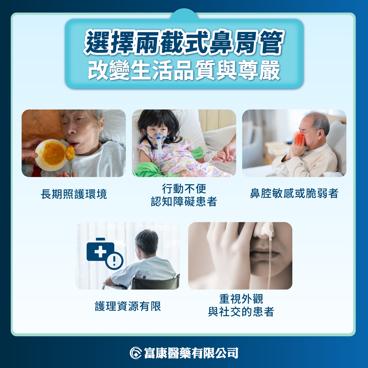 選擇兩截式鼻胃管改善生活