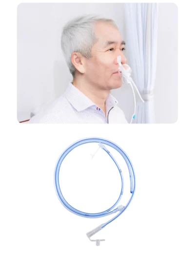 富康醫藥-阿爾傑兩截式鼻胃管
